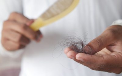 ¿Por qué se me cae el pelo? Causas habituales de la caída del cabello